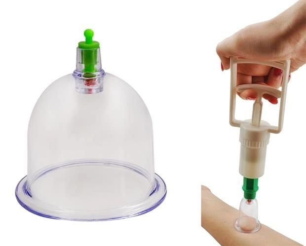 Ventouses chinoises sous vide