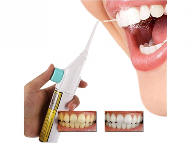 Irrigateur dentaire sans fil