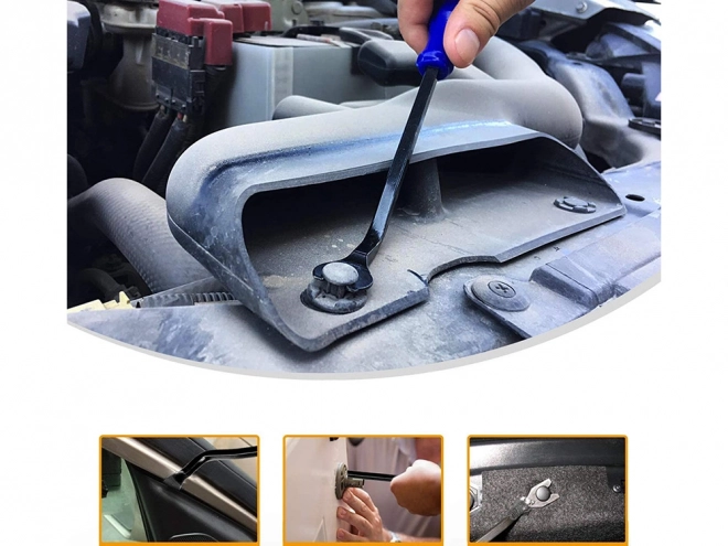 Ensemble pour extraction de garnitures et retrait de clips radio