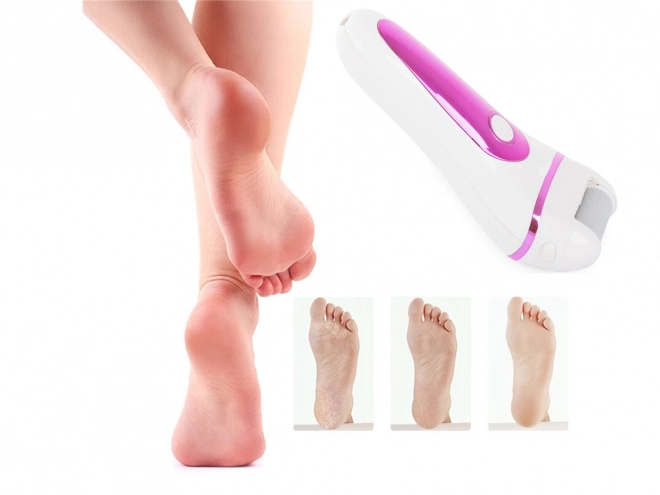 Lime électrique pour les talons avec écran LCD